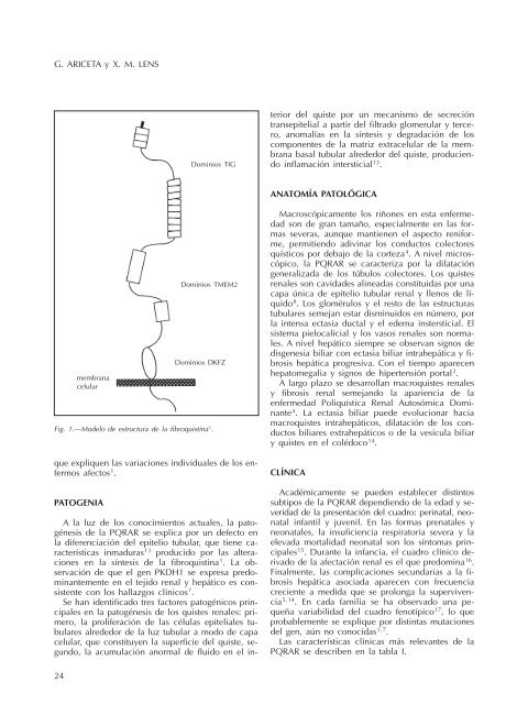 Poliquistosis renal autosómica recesiva - Nefrología