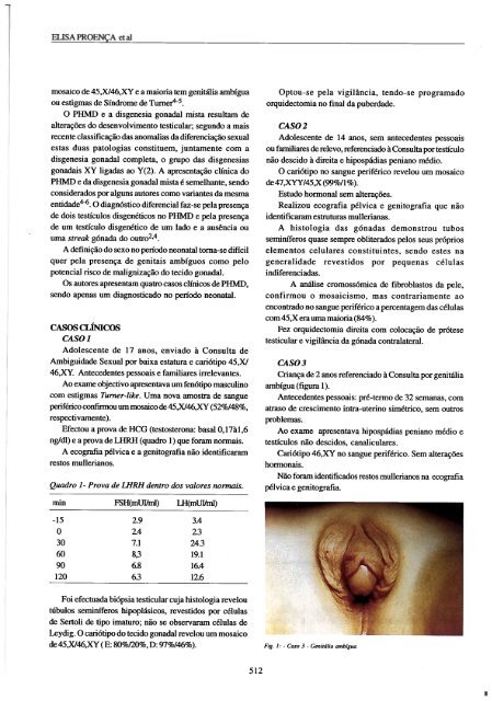 Pseudohermafroditismo masculino disgenético - Acta Médica ...