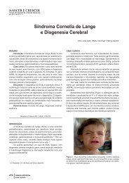 Síndroma Cornelia de Lange e Disgenesia Cerebral