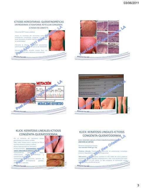 ICTIOSIS - AEDV