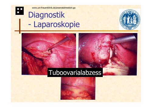 Differentialdiagnostik der Appendizitis