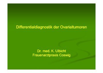 Differentialdiagnostik der Ovarialtumoren