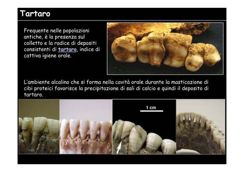Antropologia dentaria - Università degli Studi della Tuscia