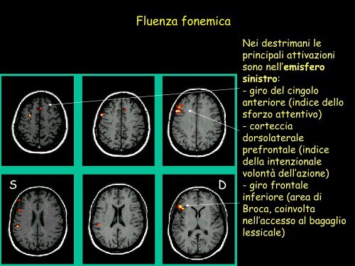 Le strutture cerebrali - Neurofisiologia.unige.it