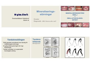 Orsaker, diagnostik – MIH, fluoros eller vad?