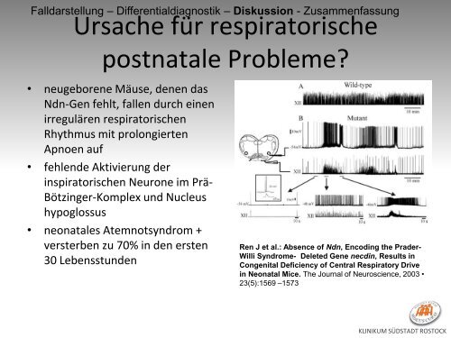 Ein Neugeborenes mit muskulärer Hypotonie ... - DGSM