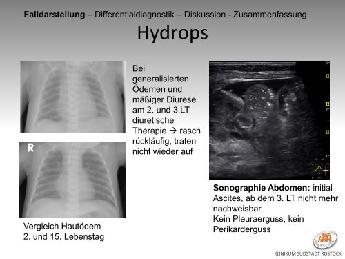 Ein Neugeborenes mit muskulärer Hypotonie ... - DGSM