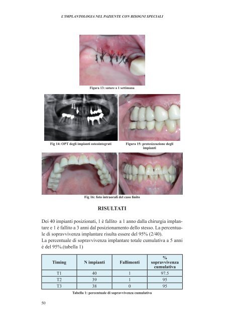 l'implantologia nel paziente con bisogni speciali - Università degli ...