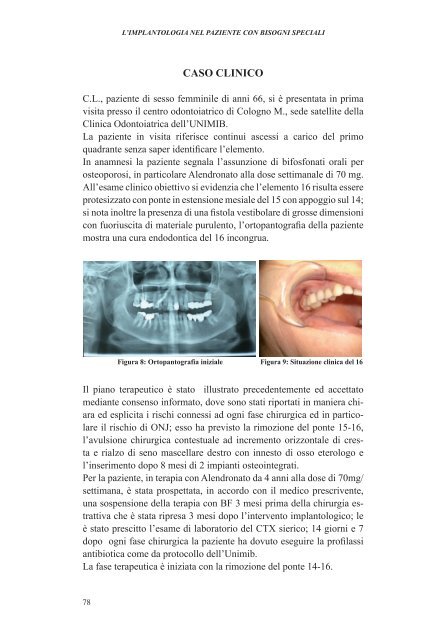 l'implantologia nel paziente con bisogni speciali - Università degli ...