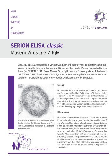SERION ELISA classic Masern Virus IgG / IgM - virion\serion