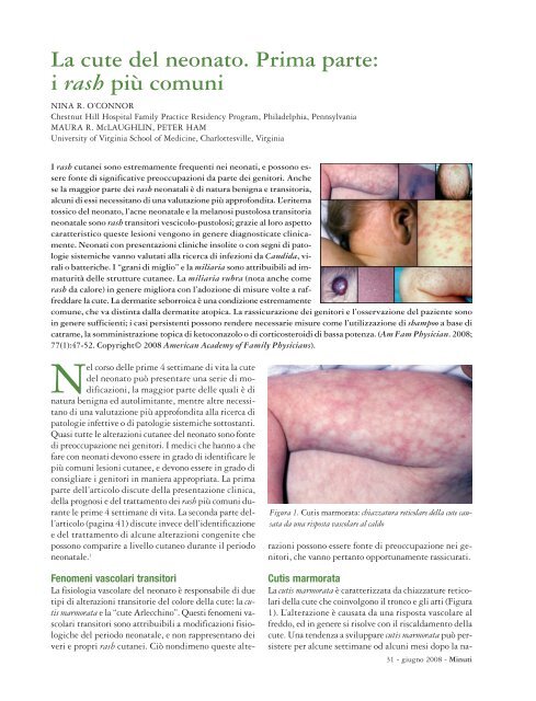 infezione cutanea al perossido di benzoile infezione cutanea al perossido di benzoile