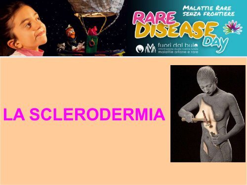 Sclerodermia - Liceo Wiligelmo