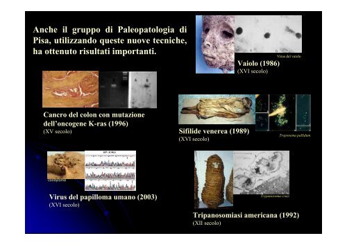 scarica la presentazione - Paleopatologia