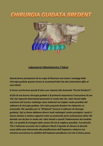 chirurgia guidata Bredent - Trident