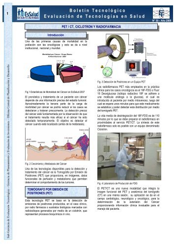 Boletín Nº 30 - PET CT, Ciclotrón y Radiofarmacia - EsSalud