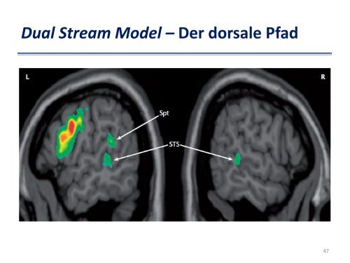 Neurobiologische Modelle der Sprache