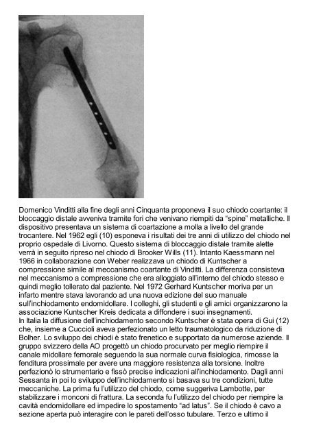 L'inchiodamento endomidollare