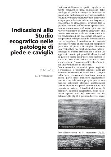 Indicazioni allo Studio ecografico nelle patologie di piede e caviglia