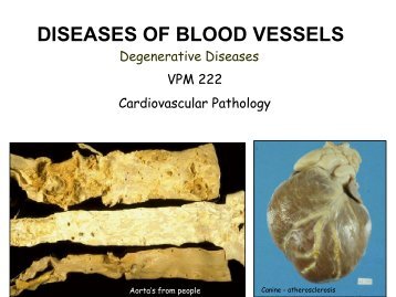 DISEASES OF BLOOD VESSELS Degenerative Diseases ...