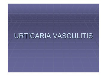 urticaria vasculitis