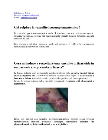Chi colpisce la vasculite ipocomplementemica ... - Dr lorenzo bettoni