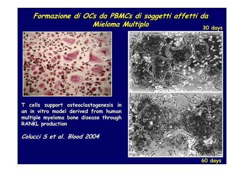 differenziamento in vitro di cellule ossee