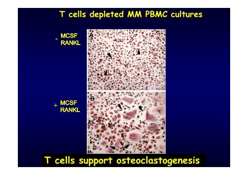 differenziamento in vitro di cellule ossee