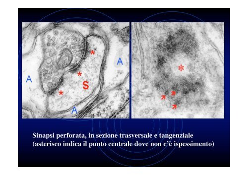 Ultrastruttura del tessuto nervoso (II)