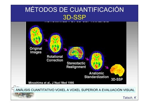 SPECT-PET in neurodegenerative diseases - NUCLEUS