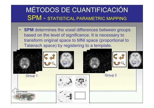 SPECT-PET in neurodegenerative diseases - NUCLEUS