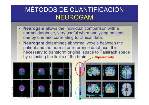 SPECT-PET in neurodegenerative diseases - NUCLEUS