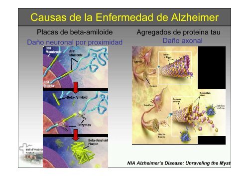 SPECT-PET in neurodegenerative diseases - NUCLEUS