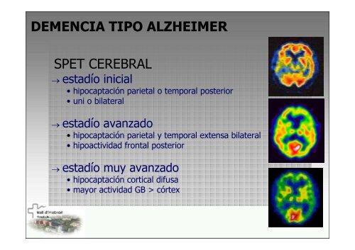 SPECT-PET in neurodegenerative diseases - NUCLEUS