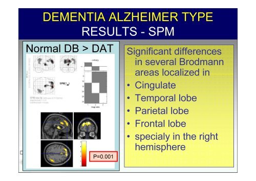 SPECT-PET in neurodegenerative diseases - NUCLEUS