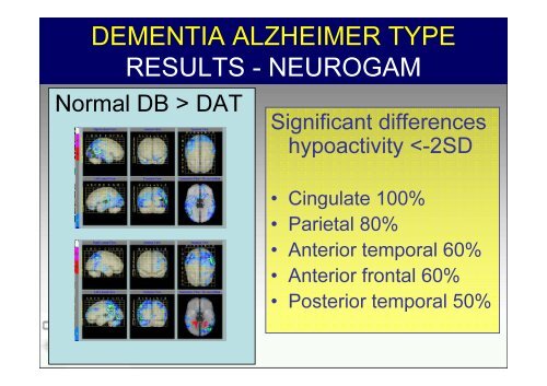 SPECT-PET in neurodegenerative diseases - NUCLEUS