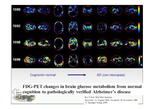 SPECT-PET in neurodegenerative diseases - NUCLEUS