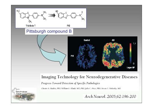 SPECT-PET in neurodegenerative diseases - NUCLEUS