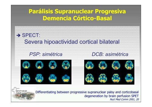 SPECT-PET in neurodegenerative diseases - NUCLEUS