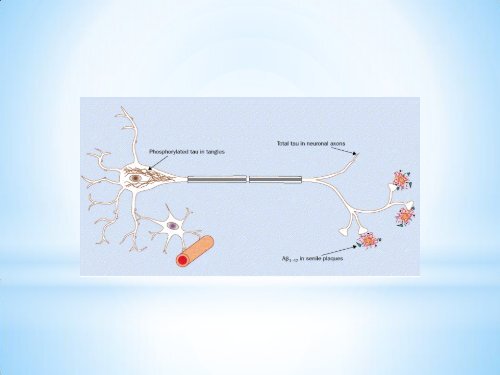 ETIOPATOGENIA DA DOENÇA DE ALZHEIMER: ASPECTOS ...