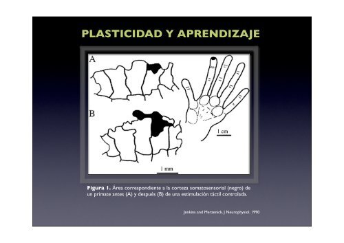 Fundamentos básicos de plasticidad fisiológica y postlesional