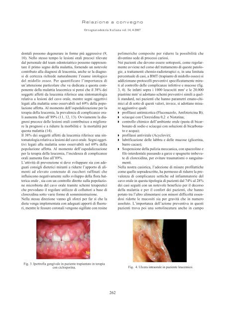 Il team odontoiatrico nelle scienze pedo-ortodontiche: approccio ...