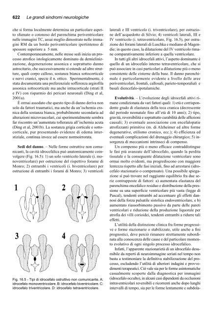 16. Sindromi da alterata pressione endocranica