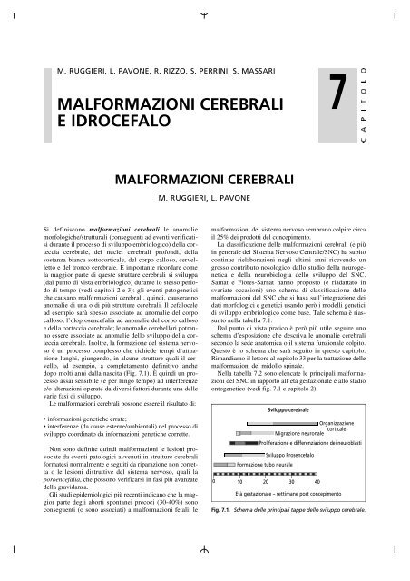 agenesia radiale definizione
