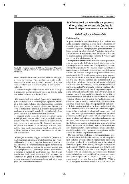 Malformazioni cerebrali - Scienze della Formazione