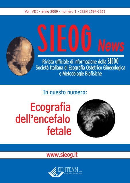 agenesia cosa è successo