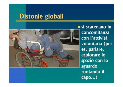 Sistemi dinamici per distonie a carattere estensorio ... - Abilitare.org