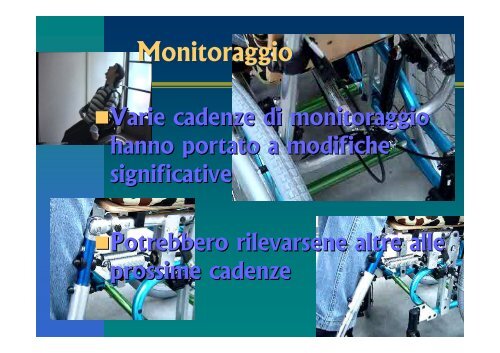 Sistemi dinamici per distonie a carattere estensorio ... - Abilitare.org