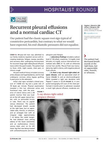 Recurrent pleural effusions and a normal cardiac CT