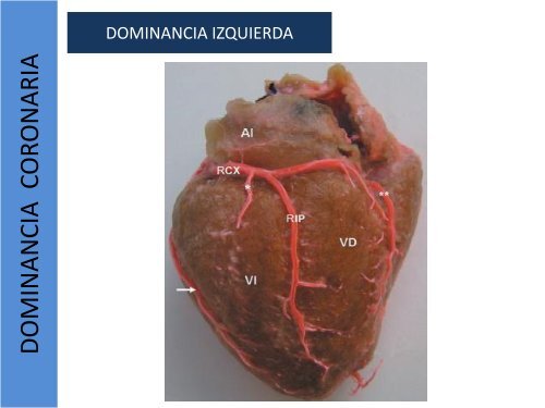 1.1-Anatomia del corazon y grandes vasos(modificado