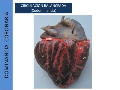 1.1-Anatomia del corazon y grandes vasos(modificado